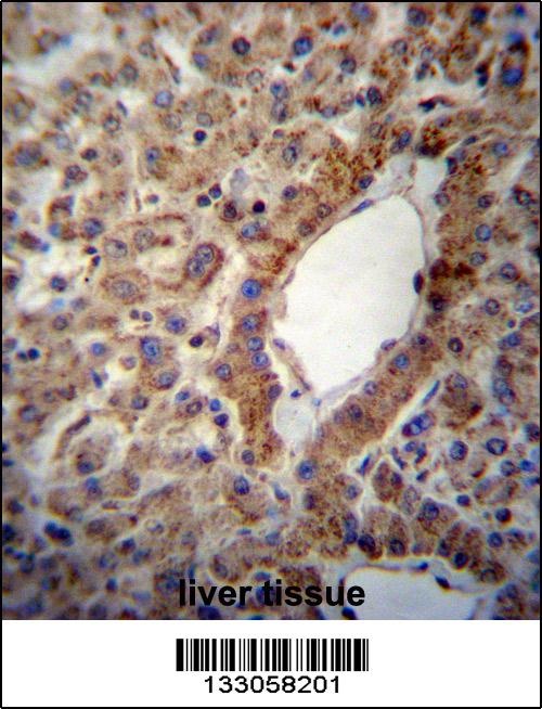 ACSS2 Antibody