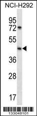 SGPP1 Antibody