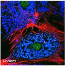 BNIP3 Antibody