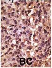 BNIP3 Antibody