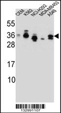 SSX4 Antibody