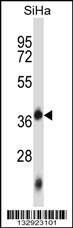 DNTTIP1 Antibody