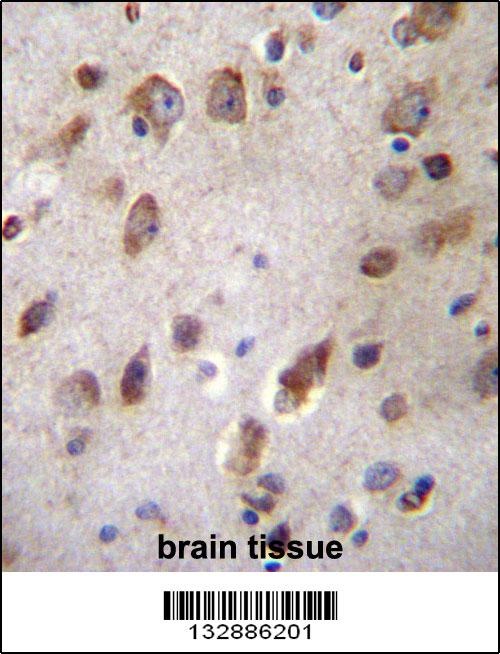 B3GNT1 Antibody