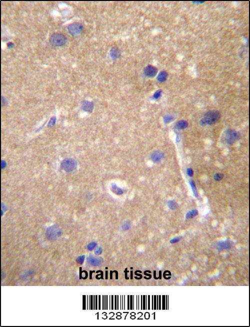 ABCC12 Antibody