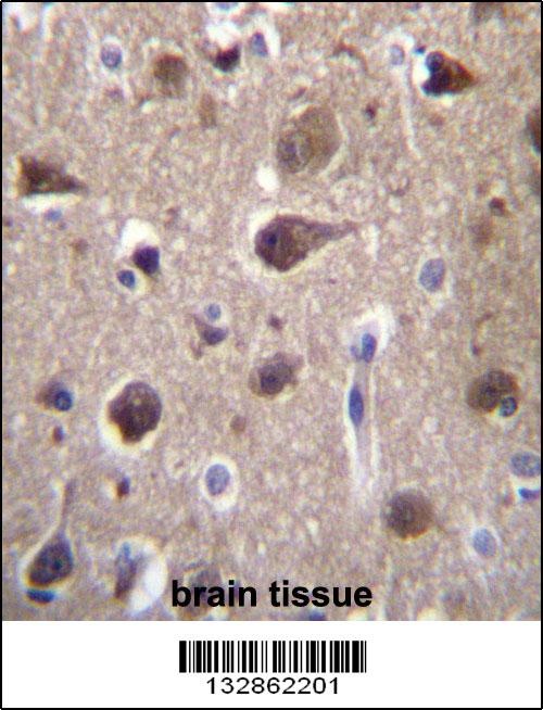 MRAP2 Antibody