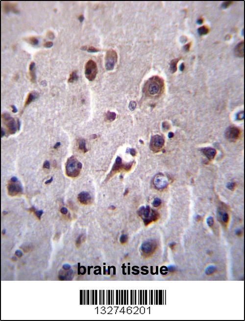 TMEM55B Antibody