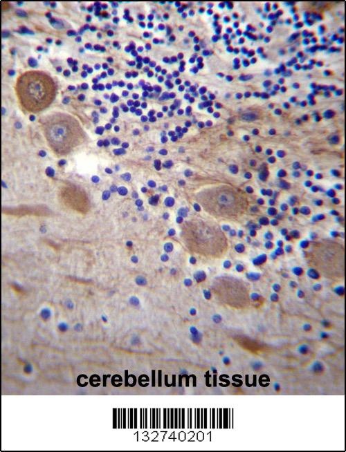 SSR2 Antibody