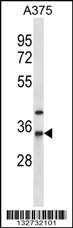 NAT1 Antibody
