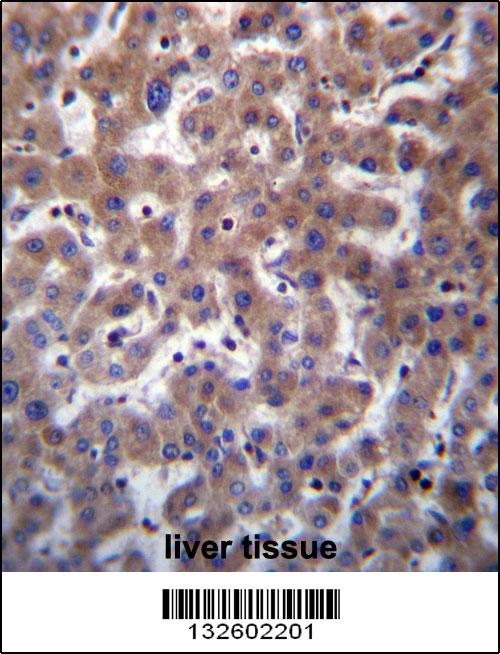 TMBIM1 Antibody