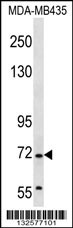 GRHL2 Antibody