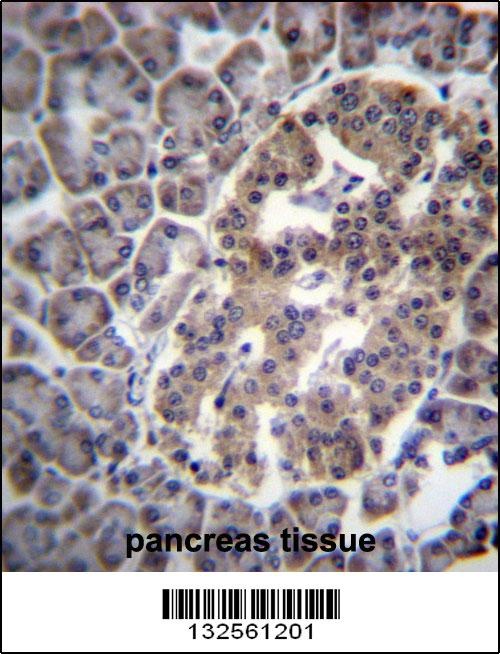 DNAJC14 Antibody