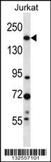 UGGT1 Antibody
