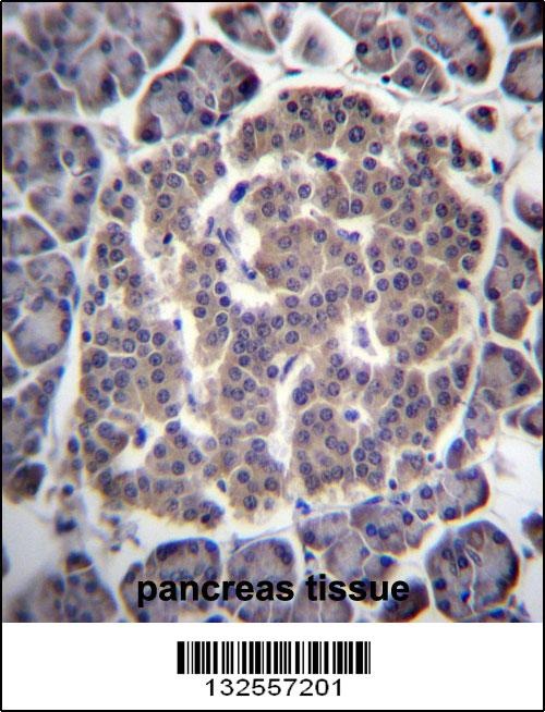 UGCGL1 Antibody