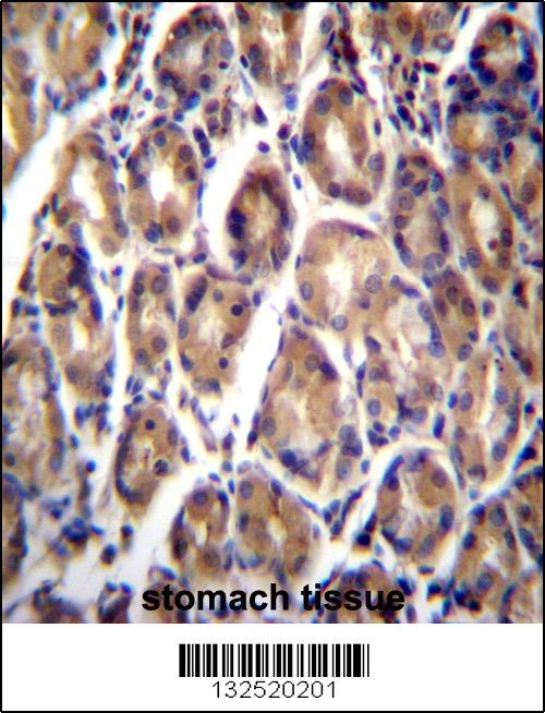 RARRES1 Antibody