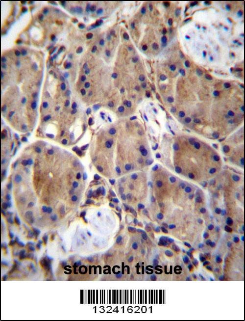 LIMD1 Antibody