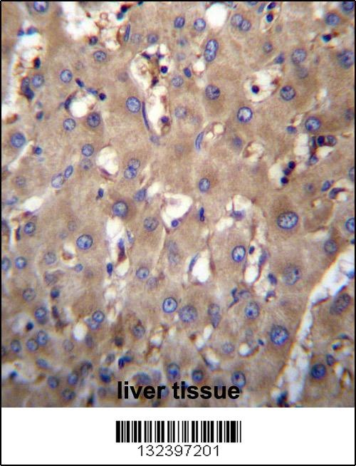 SEC63 Antibody