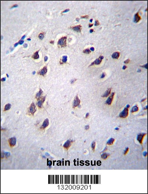LSM12 Antibody