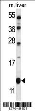 GOT1B Antibody