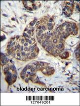 GOT1B Antibody