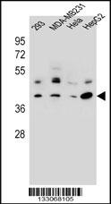RRAGC Antibody