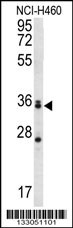 MBNL3 Antibody