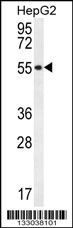 UXS1 Antibody