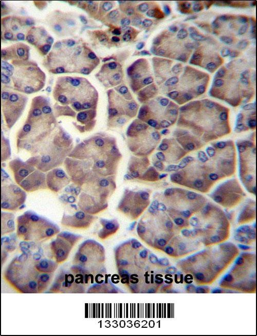 WDR12 Antibody