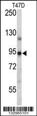 PGR Antibody