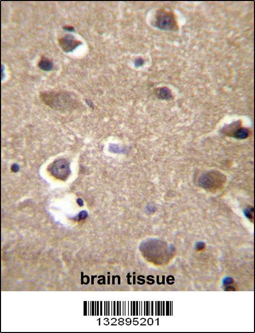 MRPL9 Antibody