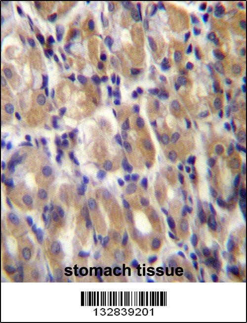 TOR1B Antibody