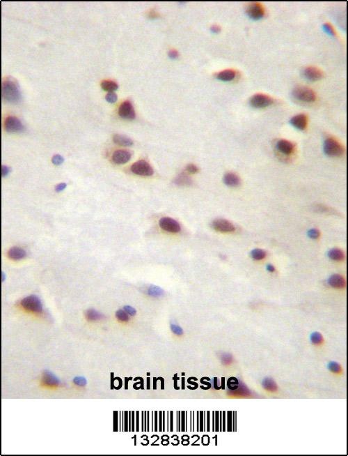 ANKRD6 Antibody