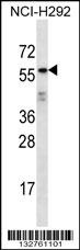 ODF2L Antibody
