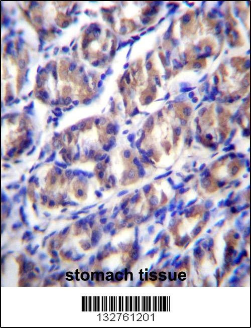 ODF2L Antibody