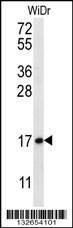 TBCA Antibody