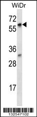 LARP7 Antibody