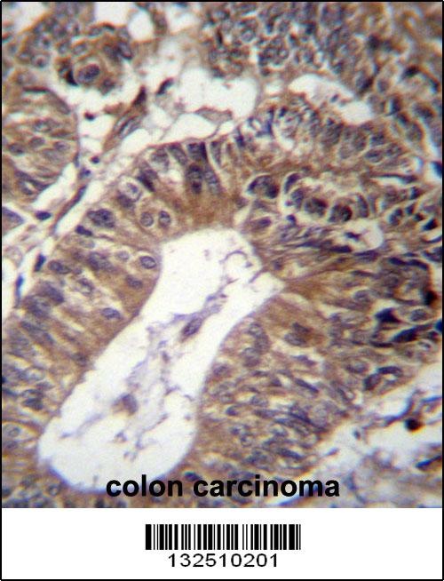 GCC1 Antibody