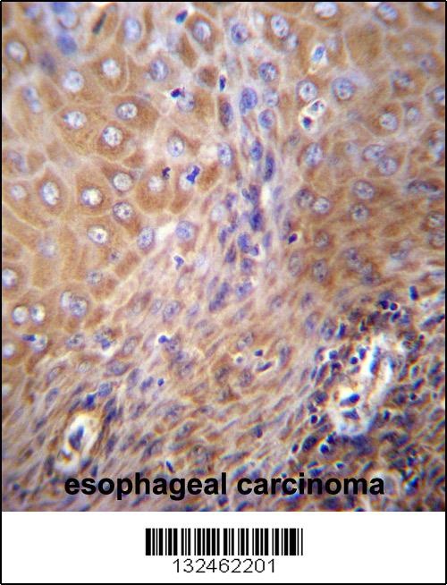 SLC6A14 Antibody