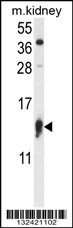 RPS12 Antibody