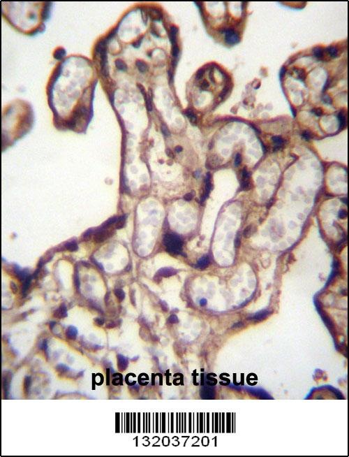 MORN3 Antibody