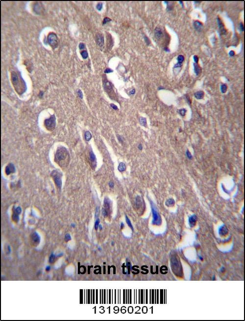 PON2 Antibody