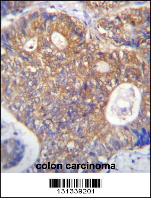 PAICS Antibody