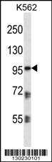 PKP2 Antibody