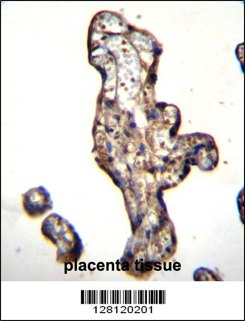 SLC15A3 Antibody