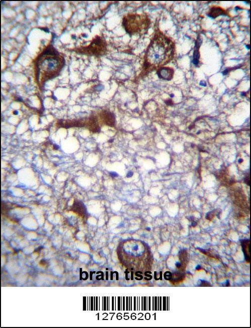 MRPL50 Antibody