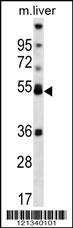 PPARA Antibody