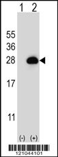 RAB3B Antibody