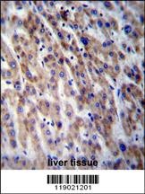 CPN1 Antibody