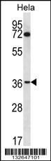 NUP35 Antibody
