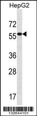 ALDH3B2 Antibody