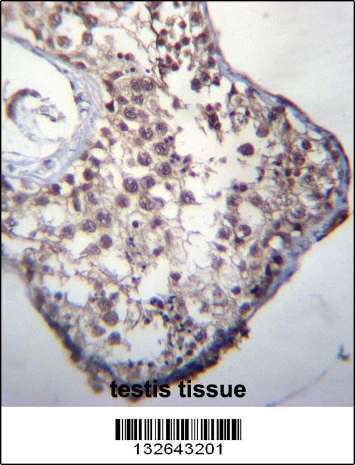 GLCCI1 Antibody